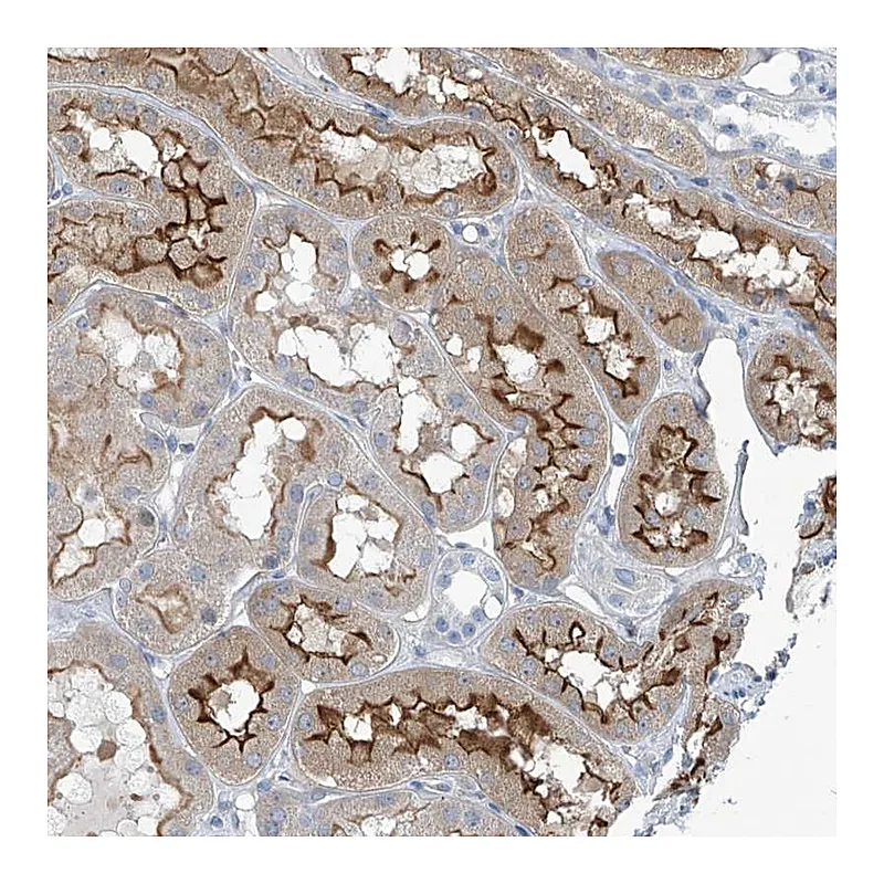 Atlas Antibodies Anti-TNN Antibody