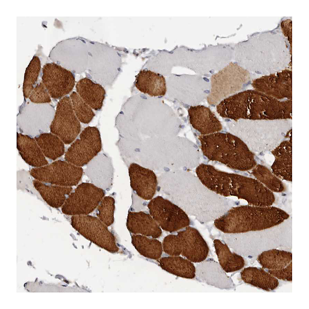 Atlas Antibodies Anti-TNNI1 Antibody