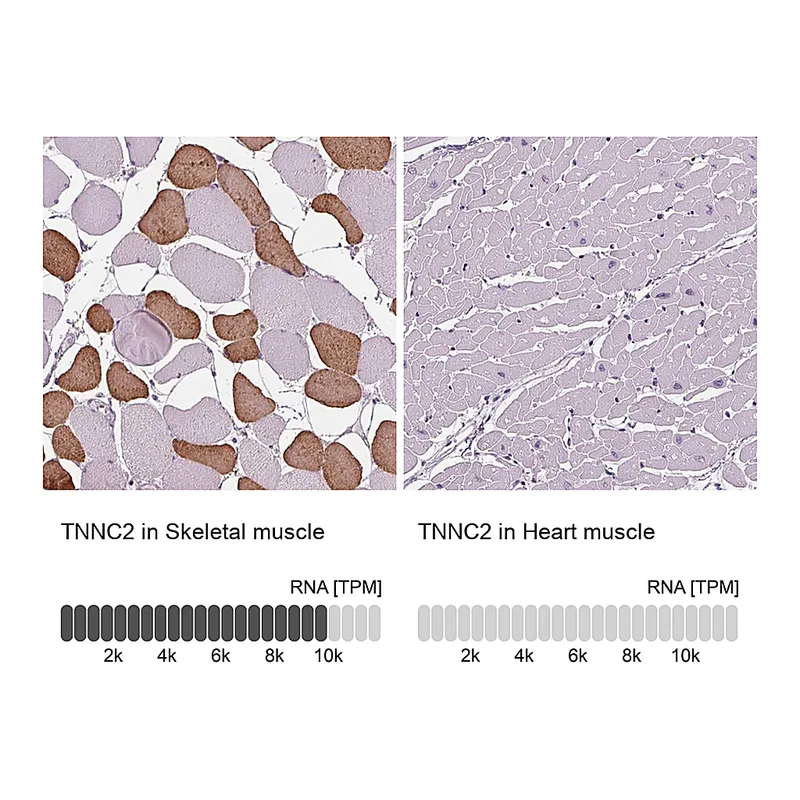 Atlas Antibodies Anti-TNNC2 Antibody