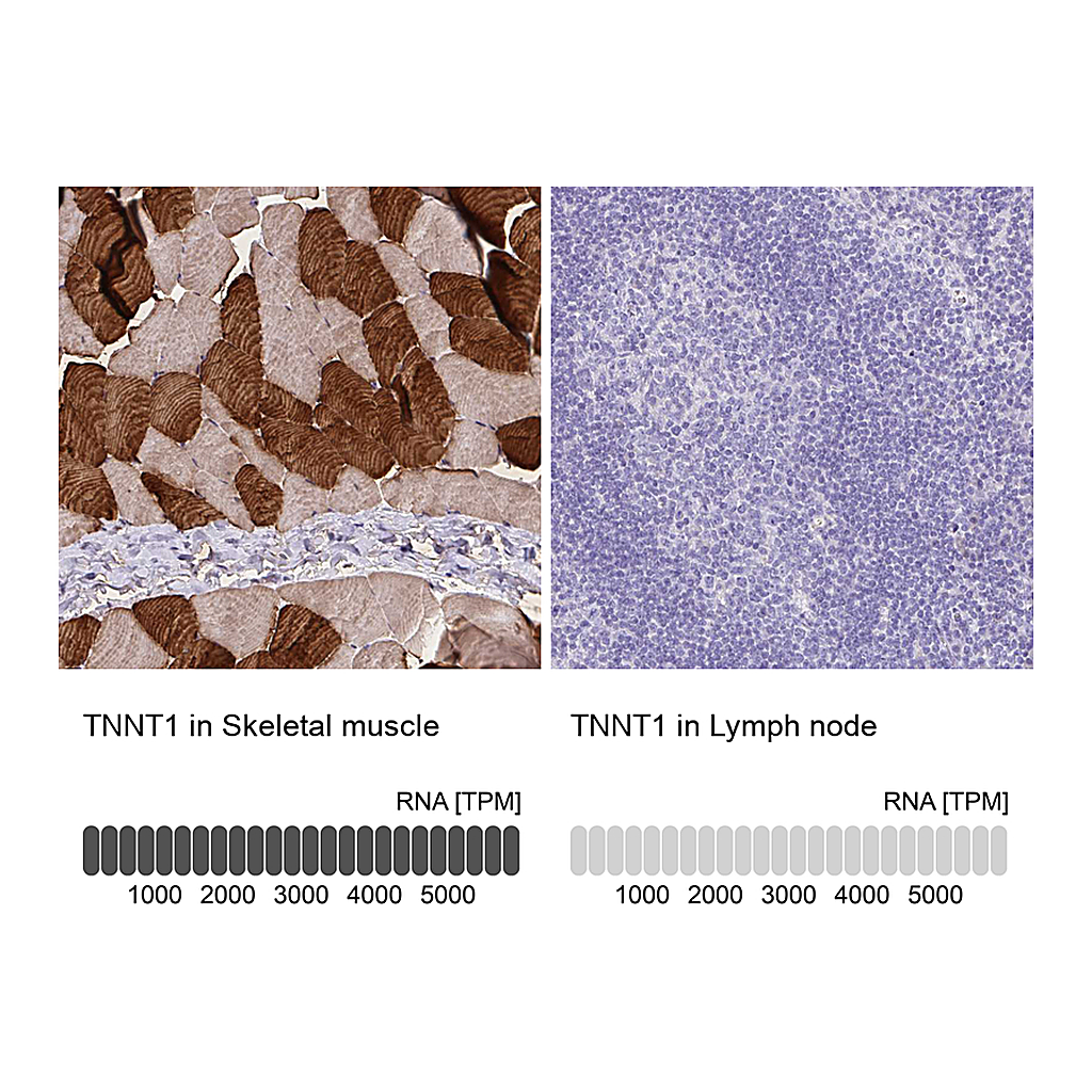 Atlas Antibodies Anti-TNNT1 Antibody
