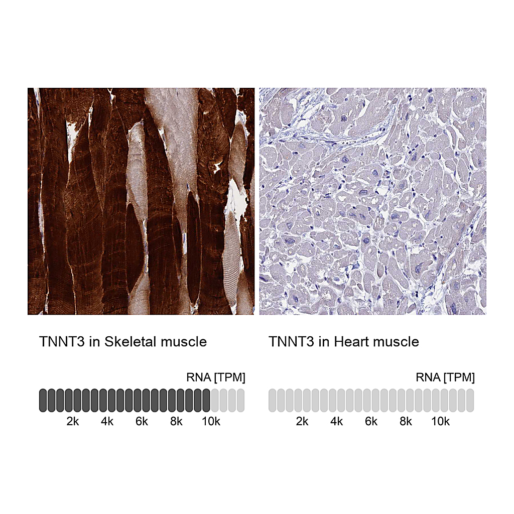 Atlas Antibodies Anti-TNNT3 Antibody