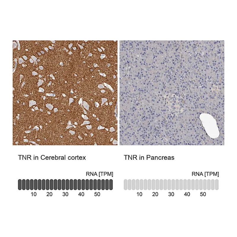 Atlas Antibodies Anti-TNR Antibody