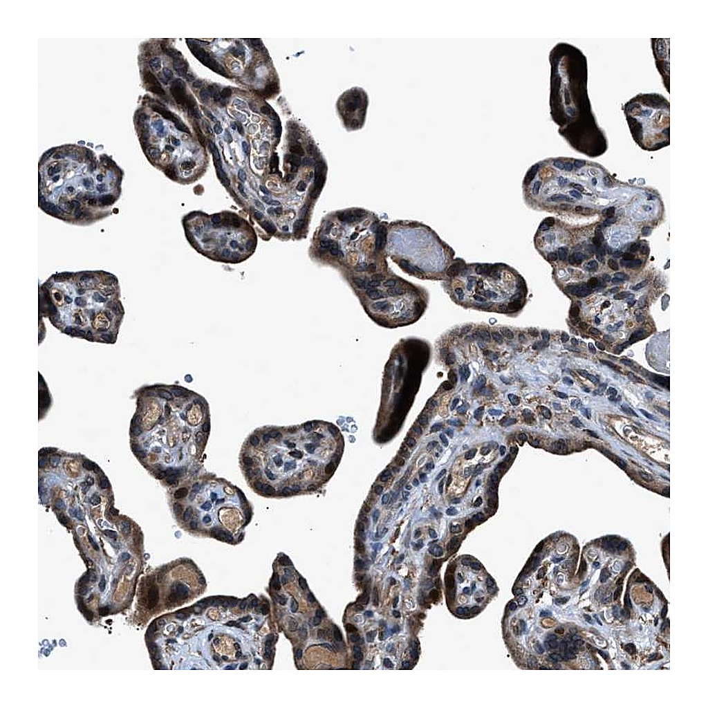 Atlas Antibodies Anti-TNRC18 Antibody