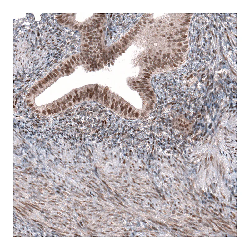 Atlas Antibodies Anti-TNRC6A Antibody