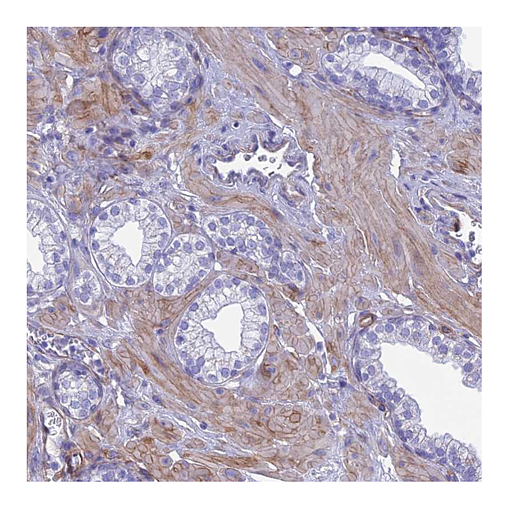 Atlas Antibodies Anti-TNS1 Antibody