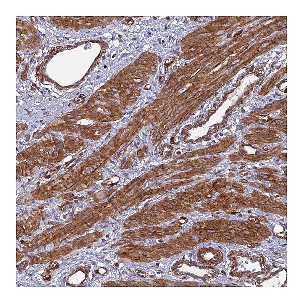 Atlas Antibodies Anti-TNS1 Antibody