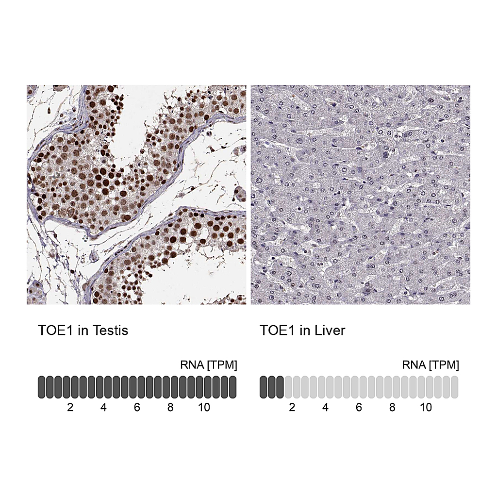 Atlas Antibodies Anti-TOE1 Antibody
