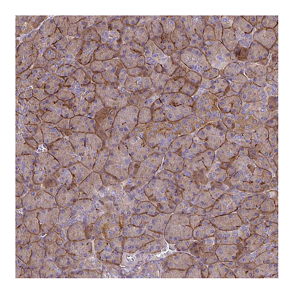 Atlas Antibodies Anti-TNS3 Antibody