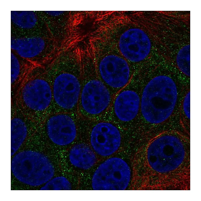 Atlas Antibodies Anti-TOB2 Antibody