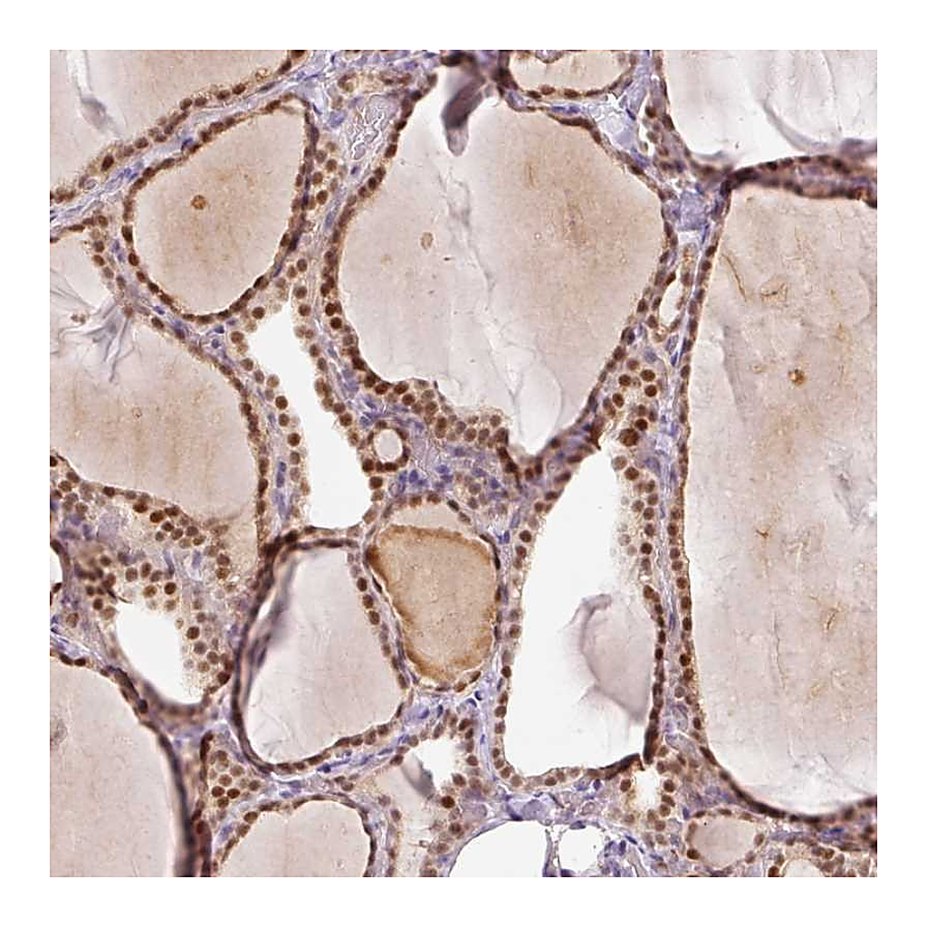 Atlas Antibodies Anti-TOGARAM1 Antibody