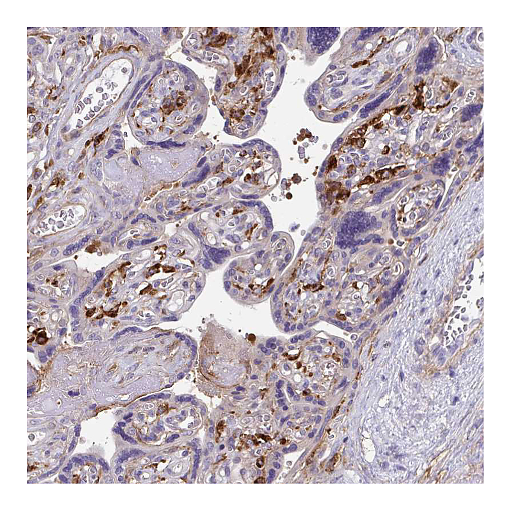 Atlas Antibodies Anti-TNS3 Antibody