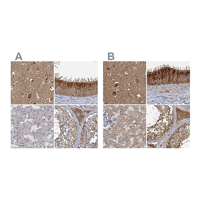 Atlas Antibodies Anti-TOLLIP Antibody