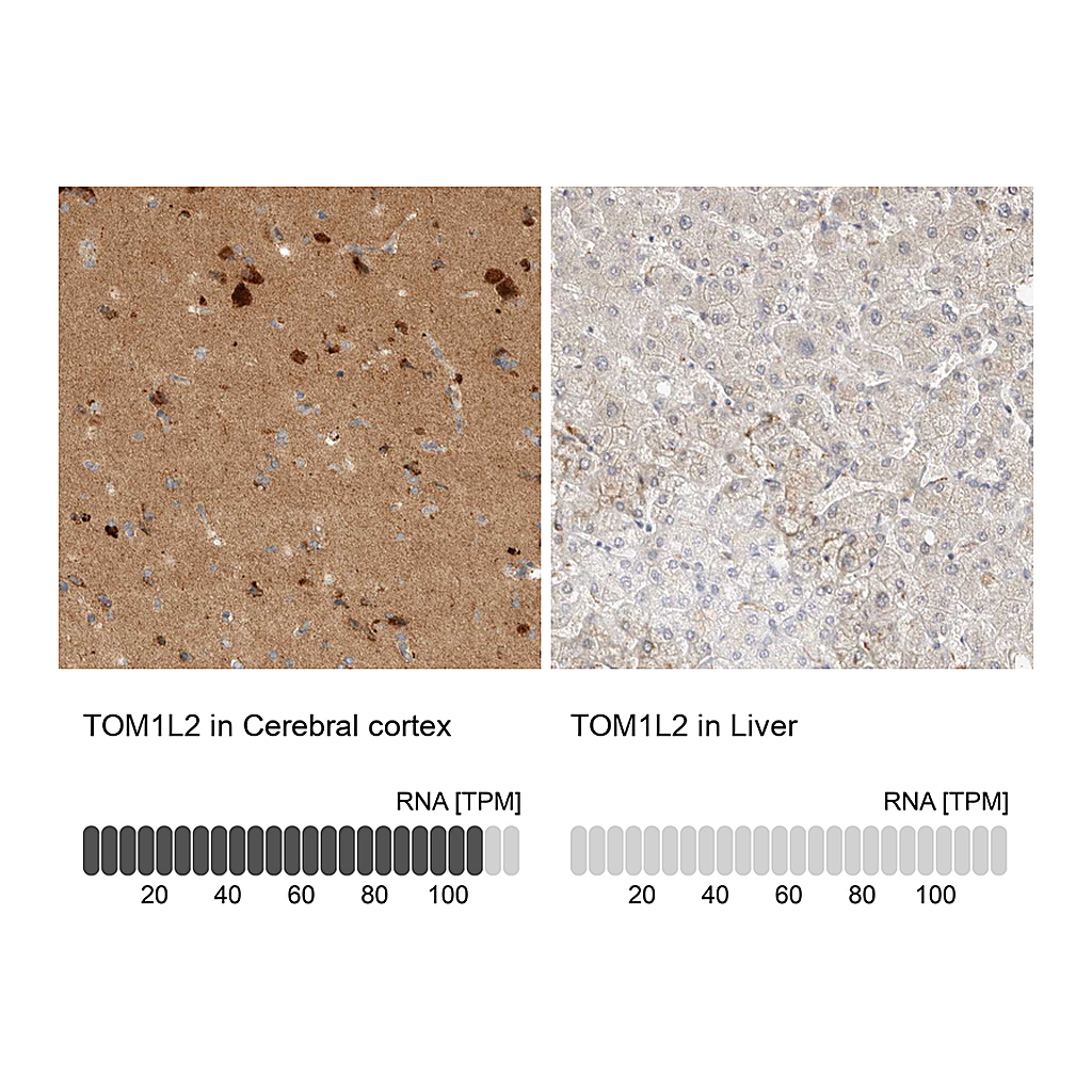 Atlas Antibodies Anti-TOM1L2 Antibody