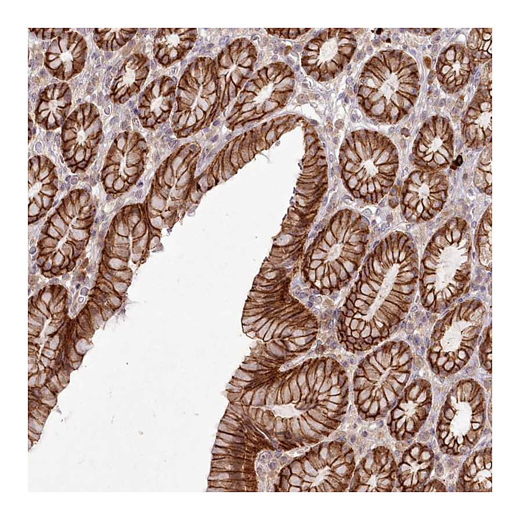 Atlas Antibodies Anti-TOGARAM2 Antibody