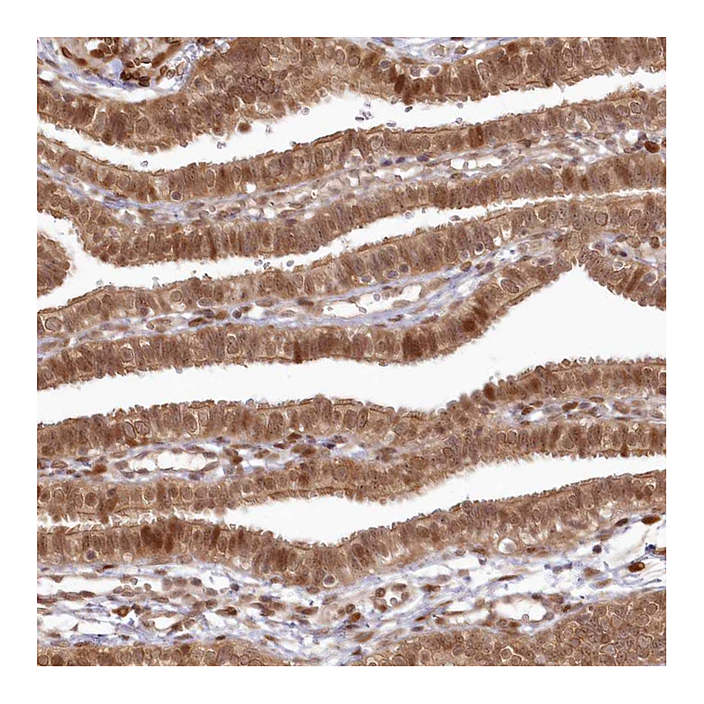 Atlas Antibodies Anti-TOGARAM2 Antibody