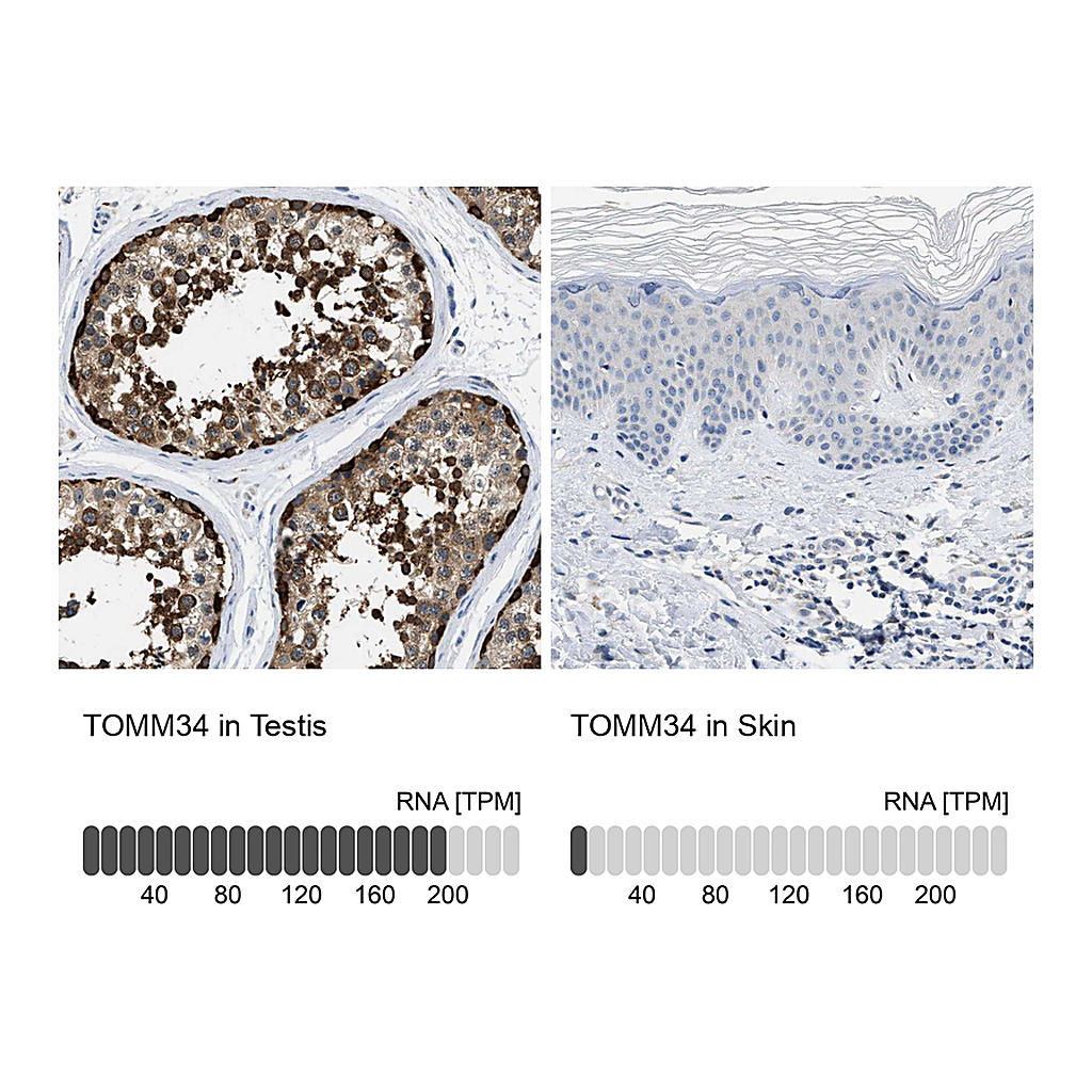 Atlas Antibodies Anti-TOMM34 Antibody