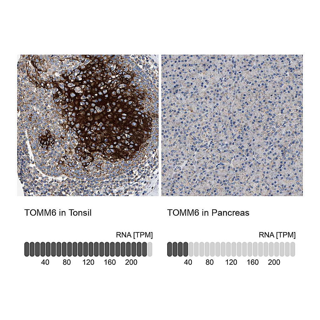 Atlas Antibodies Anti-TOMM6 Antibody