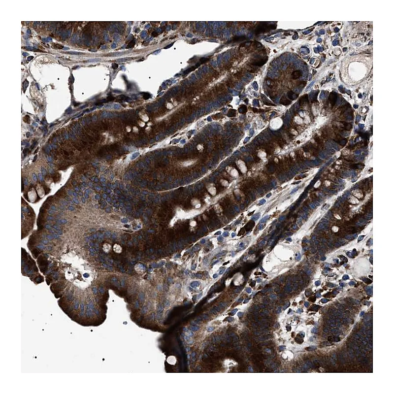 Atlas Antibodies Anti-TOP1MT Antibody