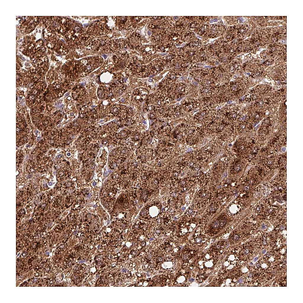 Atlas Antibodies Anti-TONSL Antibody