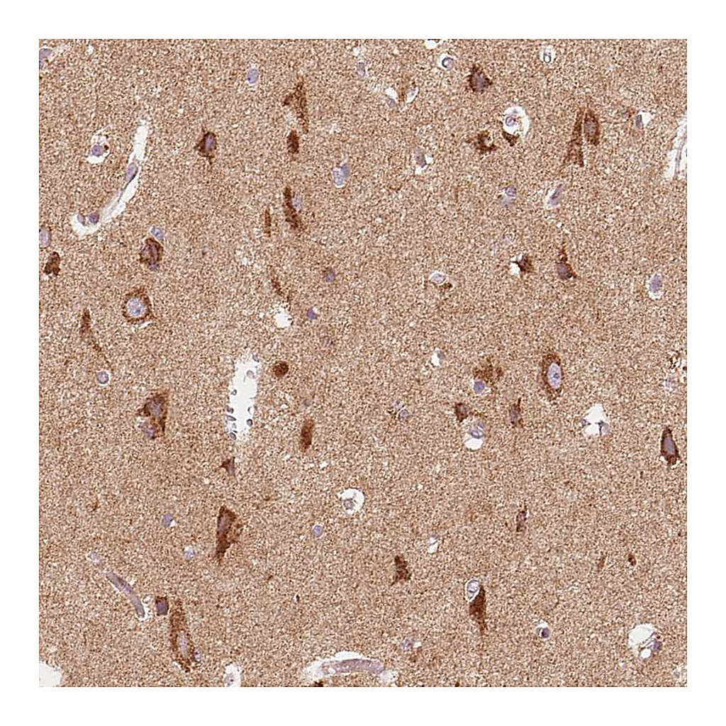 Atlas Antibodies Anti-TOMM70 Antibody