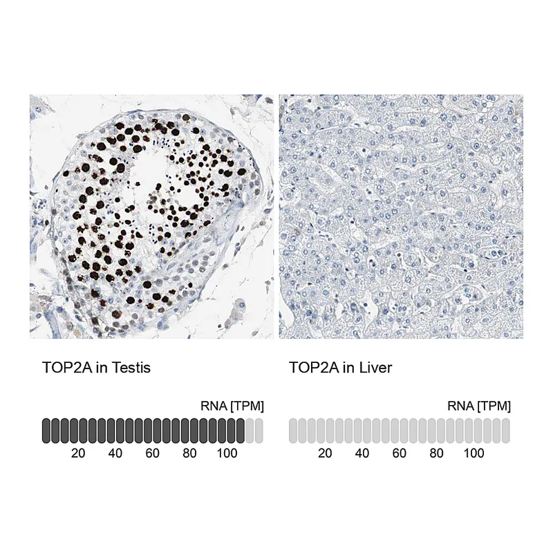 Atlas Antibodies Anti-TOP2A Antibody