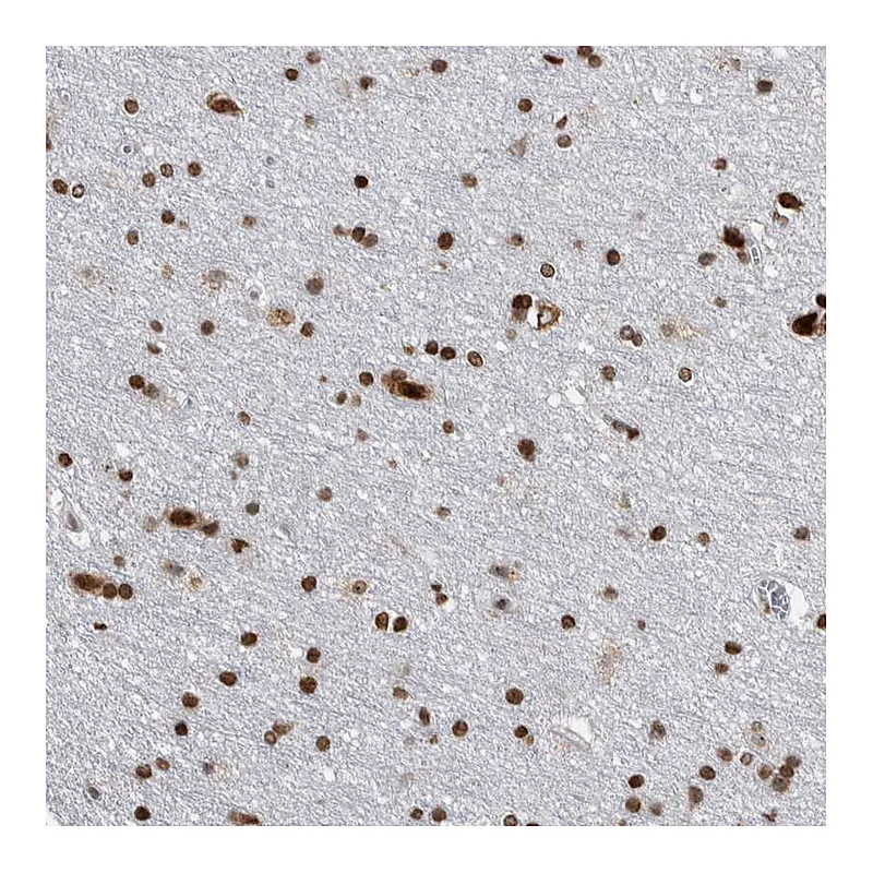 Atlas Antibodies Anti-TOP2B Antibody