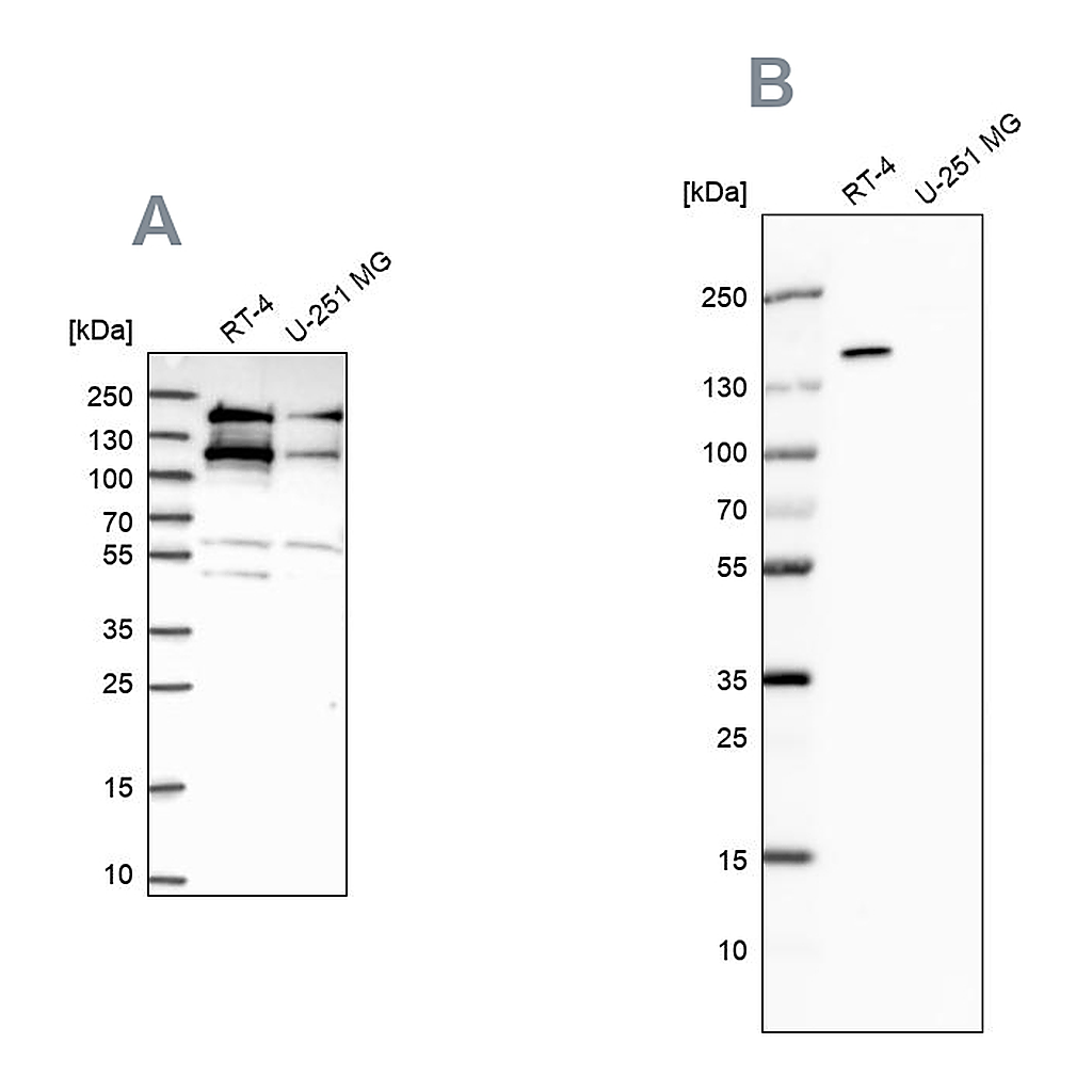 Atlas Antibodies Anti-TOP2B Antibody