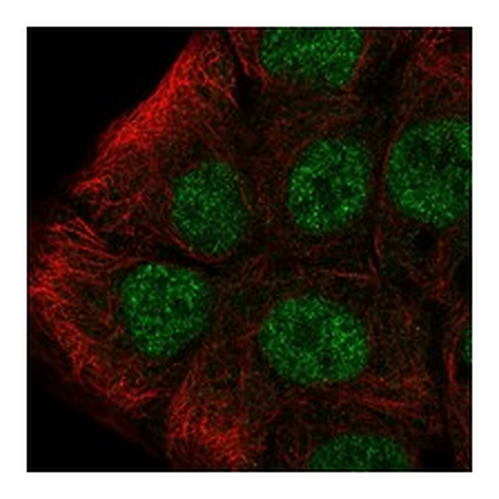 Atlas Antibodies Anti-TOP3B Antibody