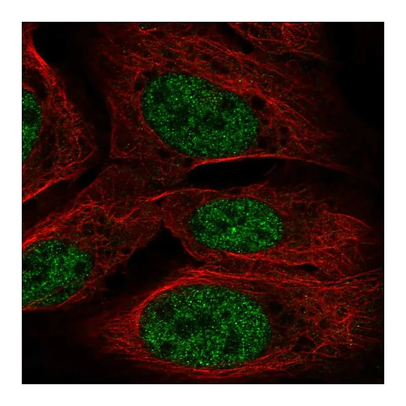 Atlas Antibodies Anti-TOPORS Antibody