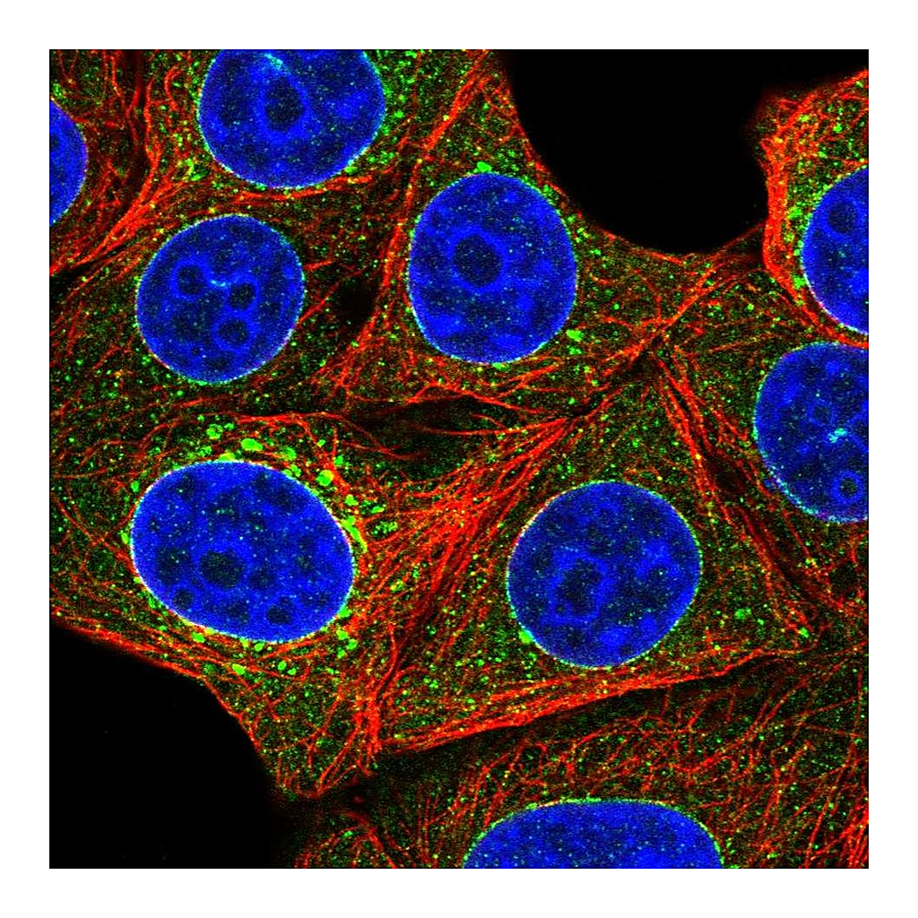 Atlas Antibodies Anti-TOR1A Antibody