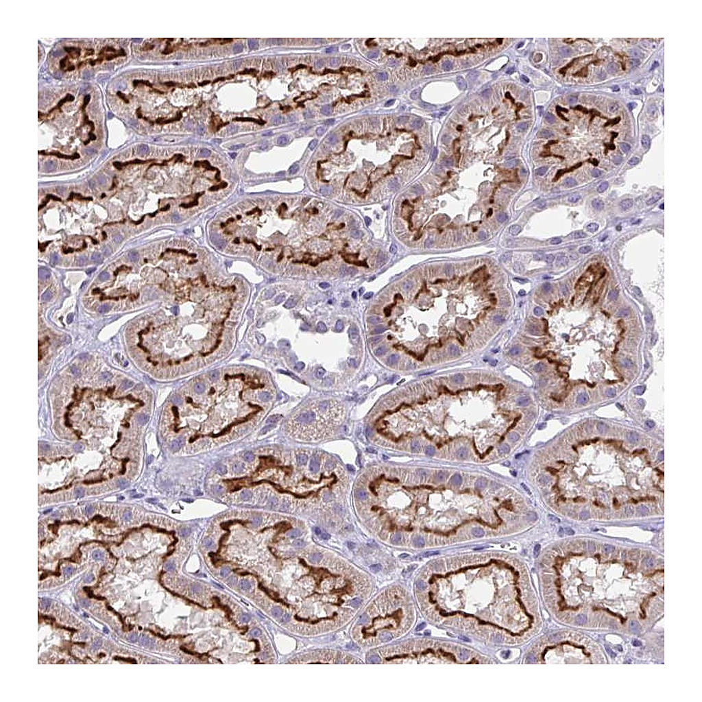 Atlas Antibodies Anti-TOR1AIP2 Antibody