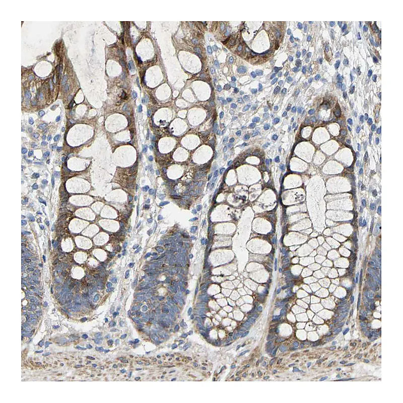 Atlas Antibodies Anti-TOR1B Antibody