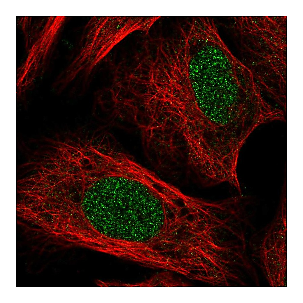 Atlas Antibodies Anti-TOX Antibody