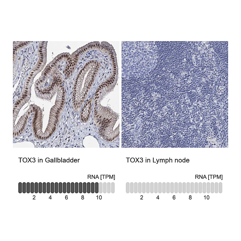 Atlas Antibodies Anti-TOX3 Antibody