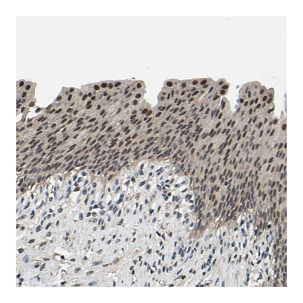Atlas Antibodies Anti-TOX4 Antibody