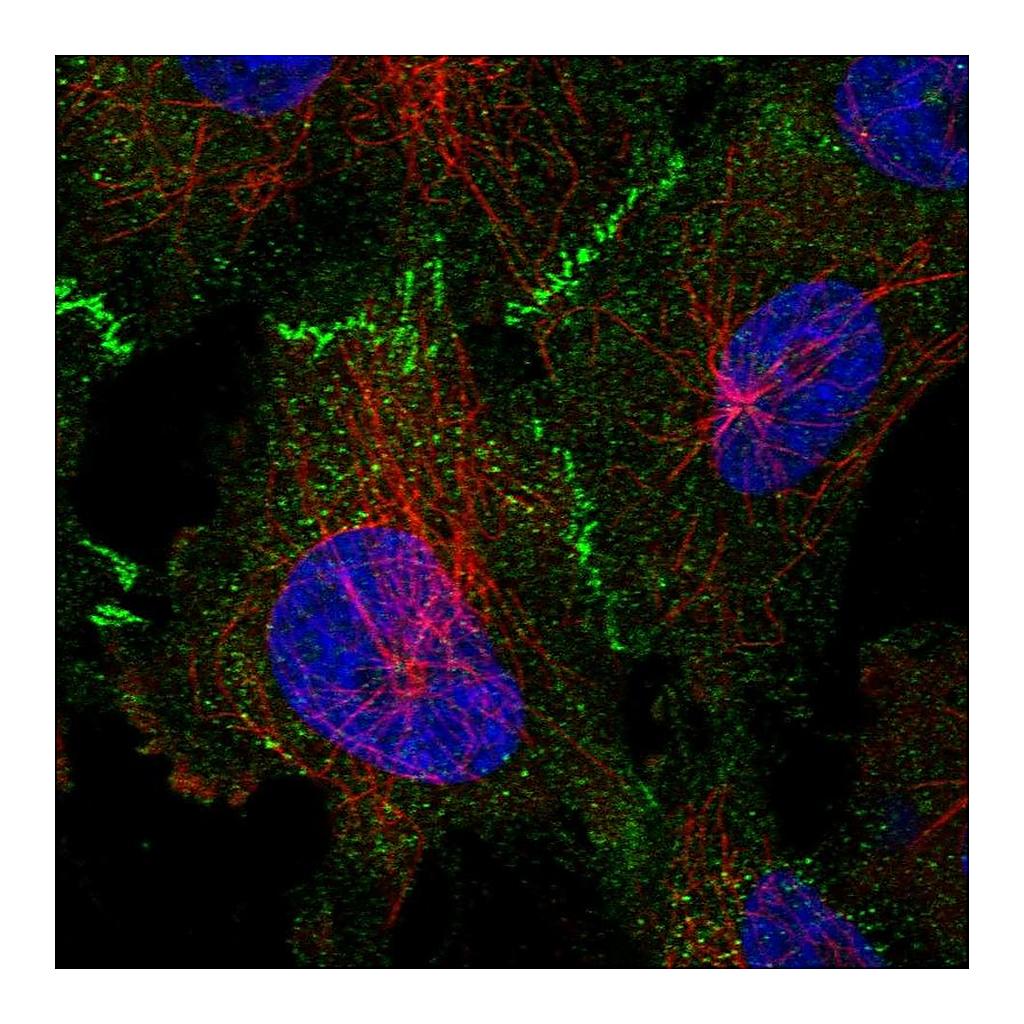 Atlas Antibodies Anti-TP53BP2 Antibody
