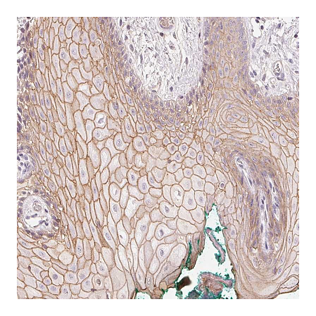 Atlas Antibodies Anti-TP53AIP1 Antibody