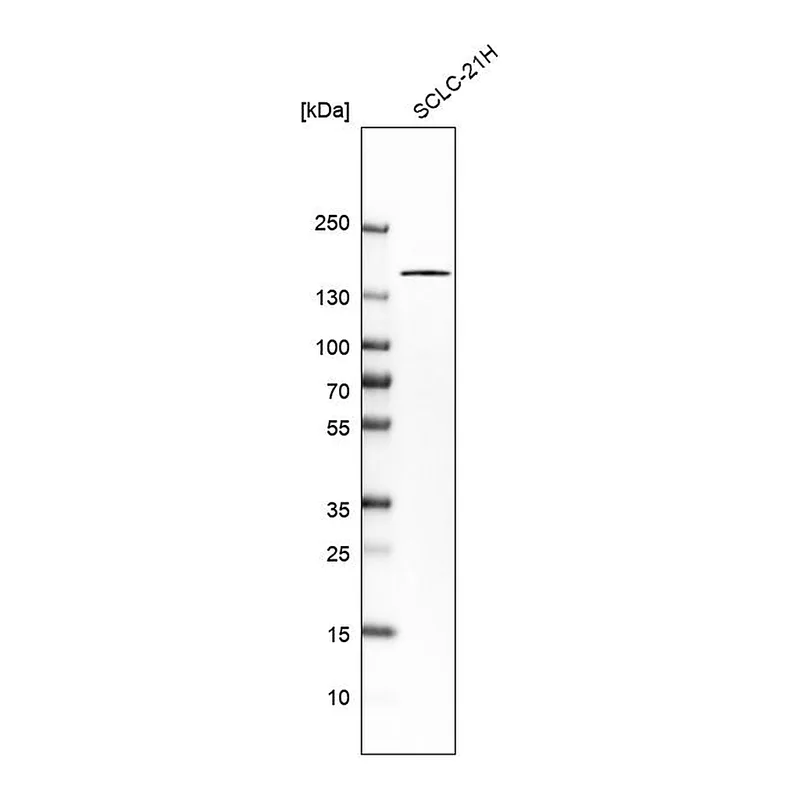 Atlas Antibodies Anti-TP53BP1 Antibody