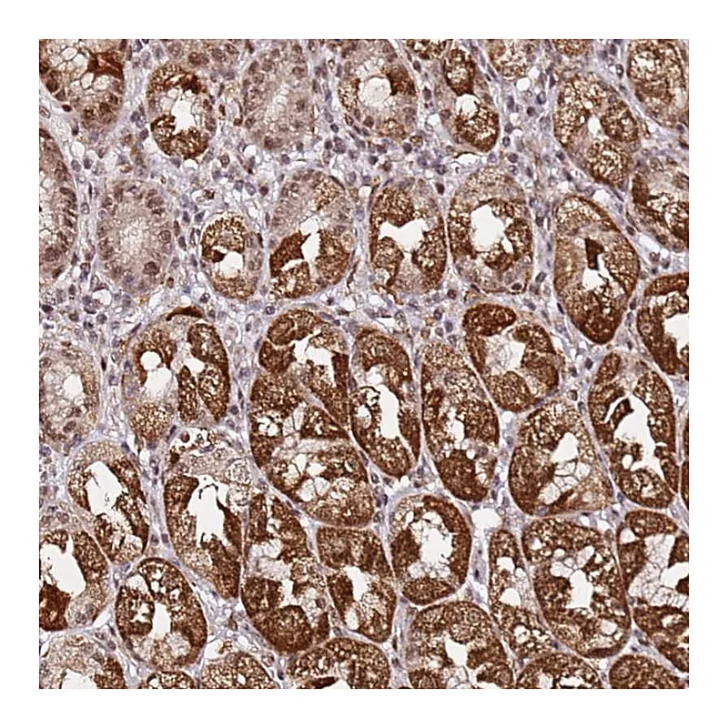 Atlas Antibodies Anti-TP53AIP1 Antibody