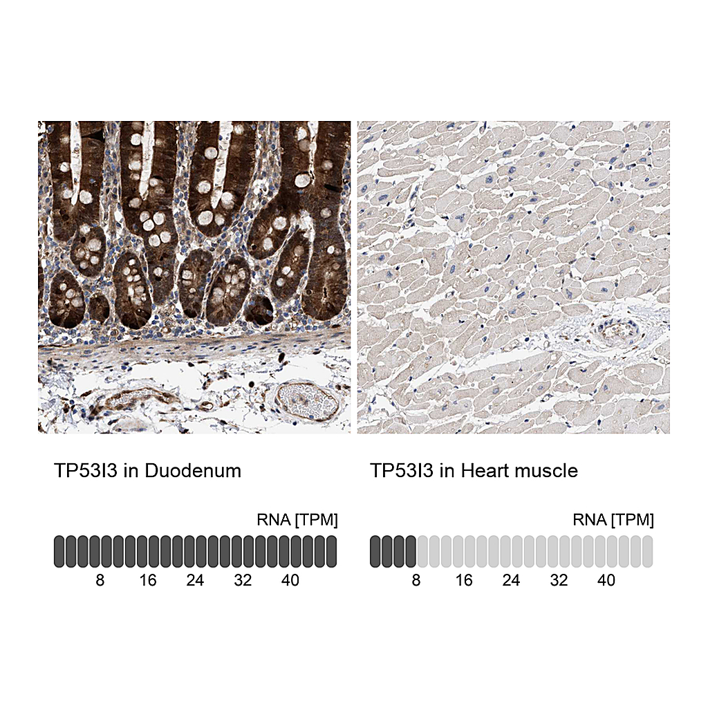 Atlas Antibodies Anti-TP53I3 Antibody