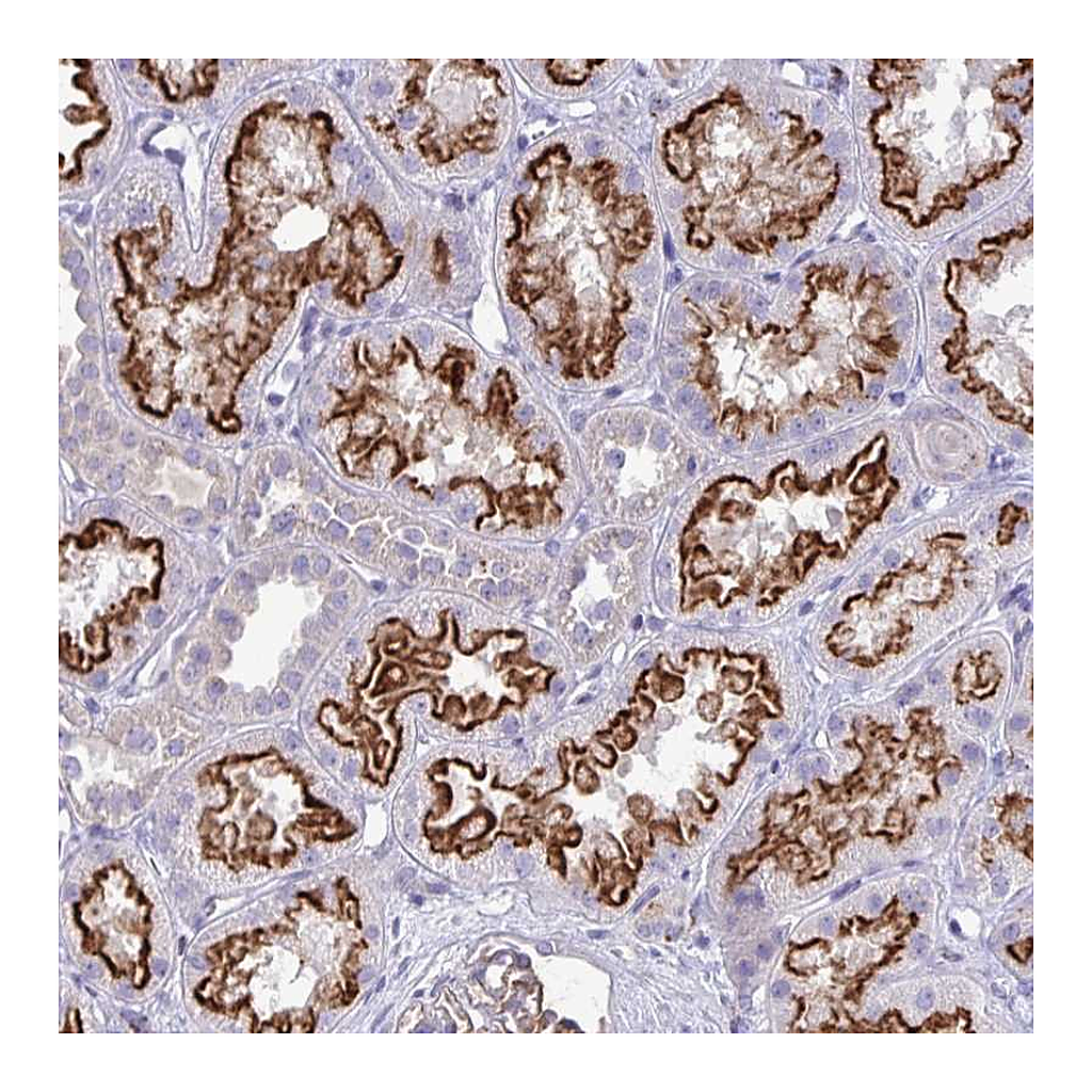 Atlas Antibodies Anti-TP53I11 Antibody