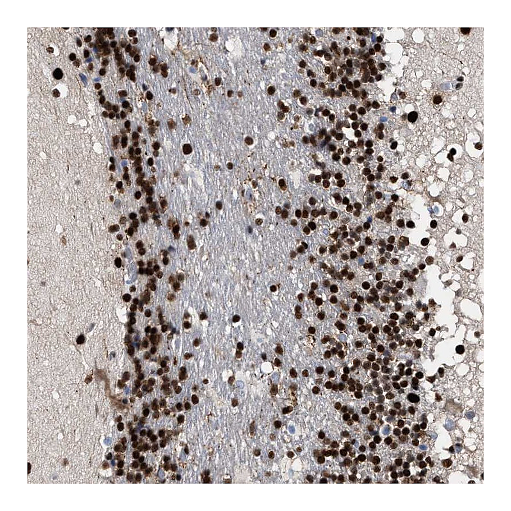 Atlas Antibodies Anti-TP53BP1 Antibody