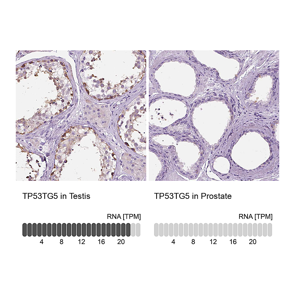 Atlas Antibodies Anti-TP53TG5 Antibody
