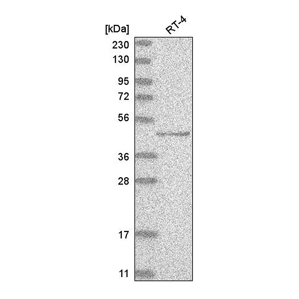 Atlas Antibodies Anti-TP73 Antibody