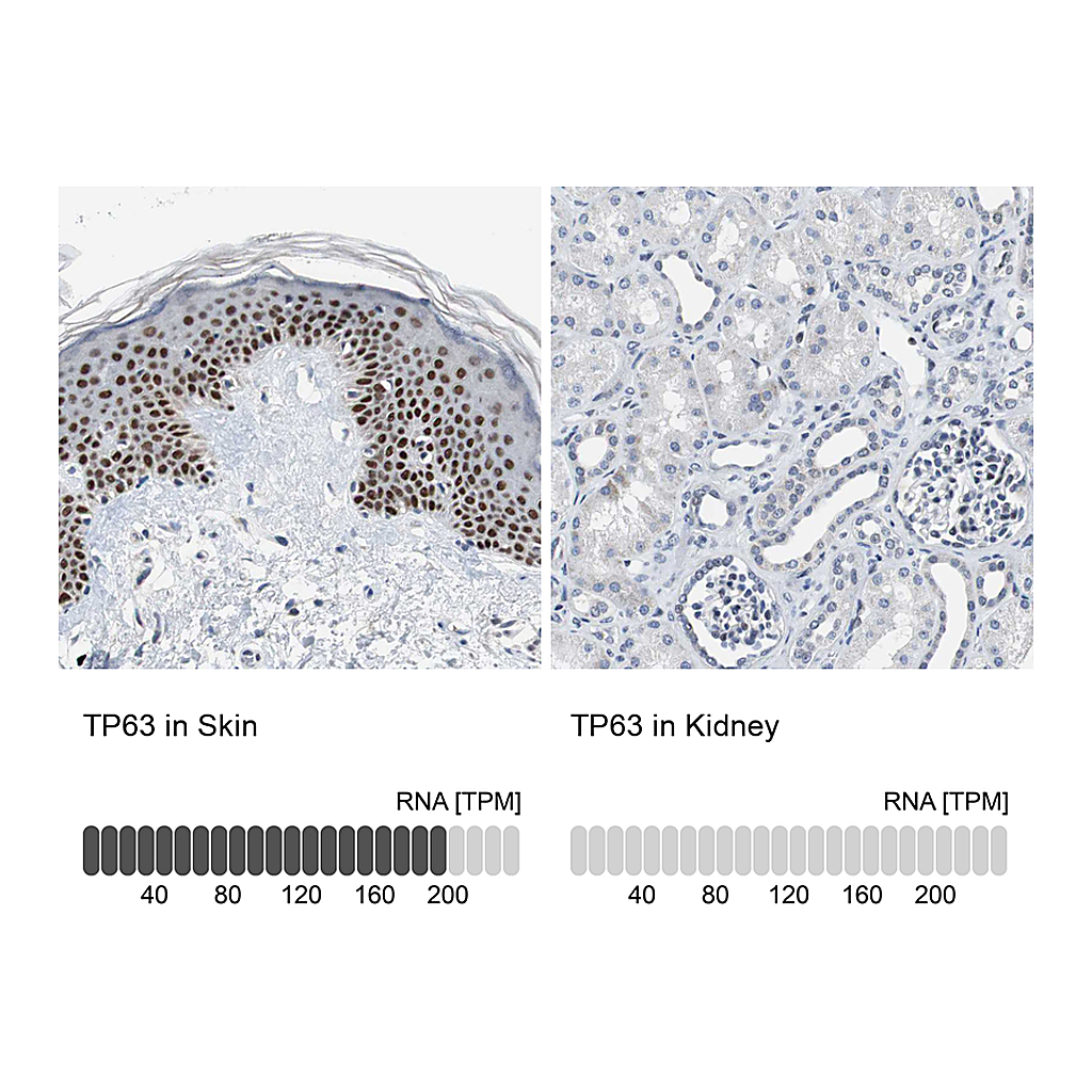 Atlas Antibodies Anti-TP63 Antibody