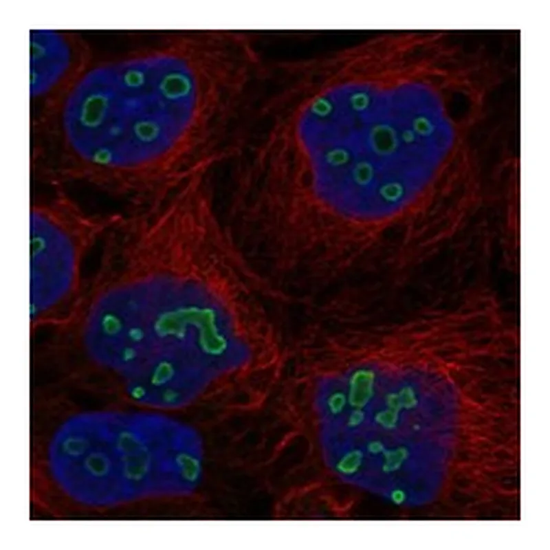 Atlas Antibodies Anti-TP53TG5 Antibody