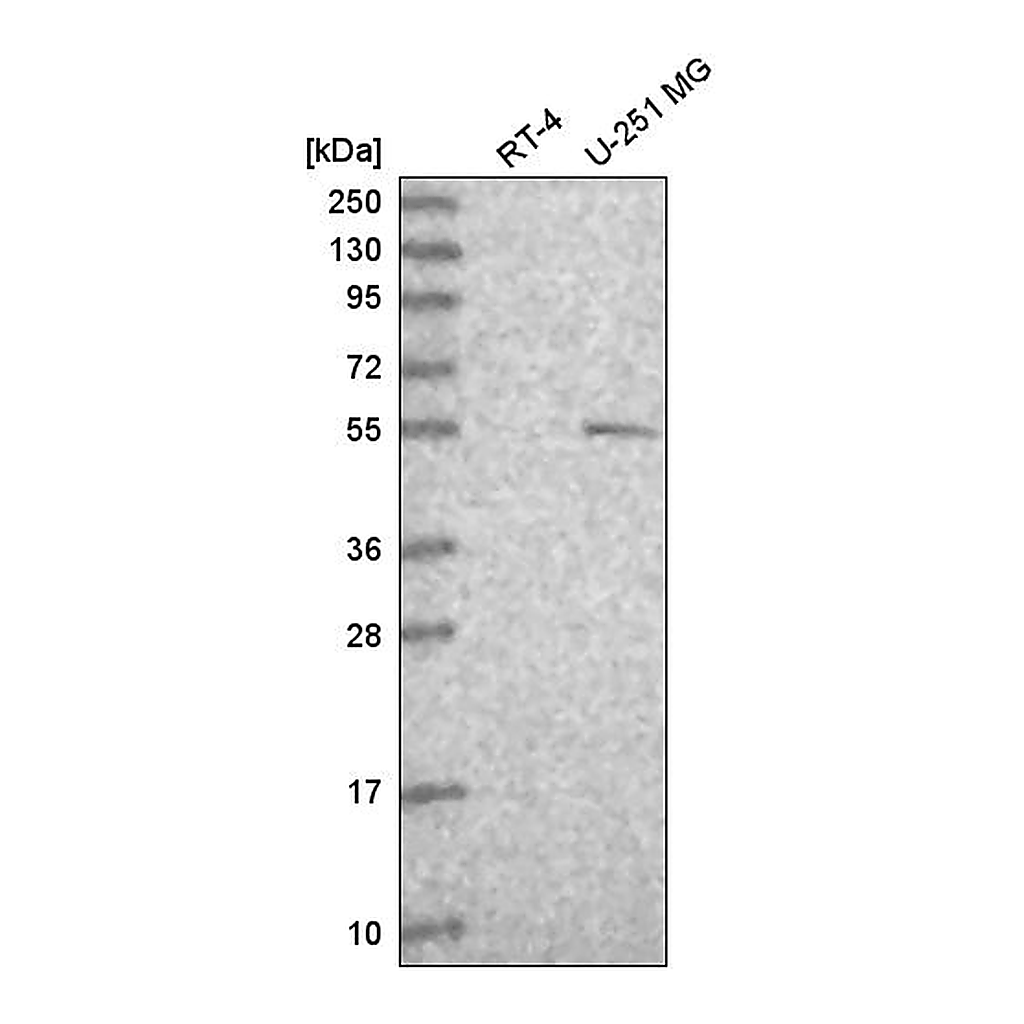 Atlas Antibodies Anti-TP73 Antibody