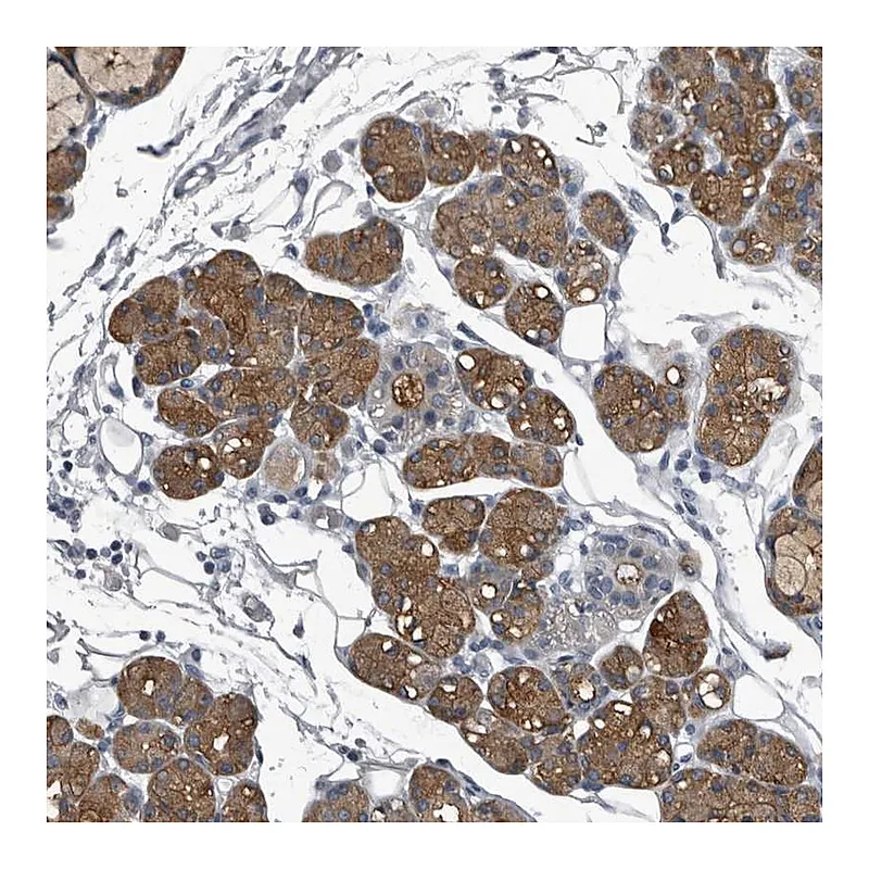 Atlas Antibodies Anti-TPD52L1 Antibody