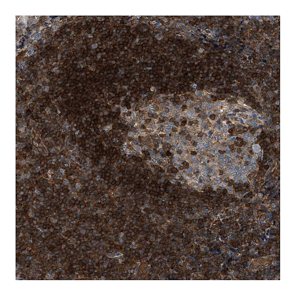 Atlas Antibodies Anti-TPK1 Antibody