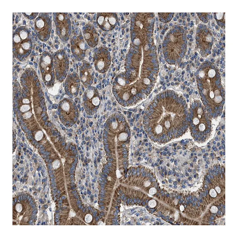 Atlas Antibodies Anti-TPK1 Antibody